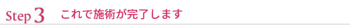 これで施術が完了します