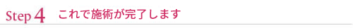 これで施術が完了します